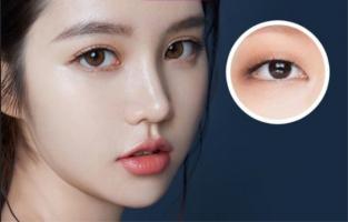 Địa chỉ nhấn mí đẹp và an toàn nhất tỉnh Thanh Hóa