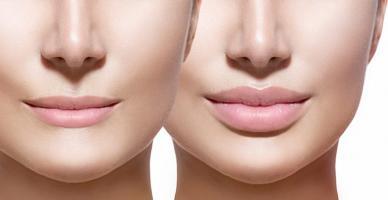 Địa chỉ tiêm filler - botox uy tín và chất lượng nhất tỉnh Thái Nguyên