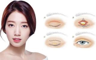 Địa chỉ nhấn mí đẹp và an toàn nhất tỉnh Vĩnh Phúc