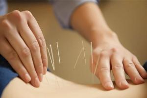 Bệnh viện châm cứu tốt nhất tại Hà Nội