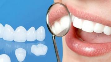 Địa chỉ bọc răng sứ uy tín nhất Thái Bình