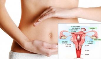 Địa chỉ đặt vòng tránh thai uy tín nhất TP. Hồ Chí Minh