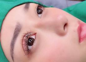 Địa chỉ nhấn mí đẹp và an toàn nhất Gia Lai