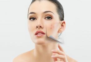 Địa chỉ nặn mụn chuẩn y khoa ở Quận 1 nổi tiếng nhất