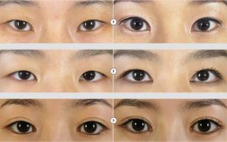 Địa chỉ mở góc mắt đẹp và chất lượng nhất Hà Nội