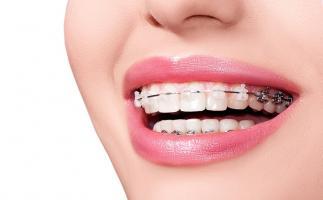 Địa chỉ niềng răng uy tín nhất tỉnh Thái Bình
