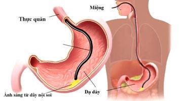 Địa chỉ nội soi dạ dày tốt và uy tín nhất tại TP. HCM