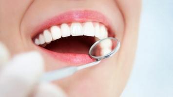 Địa chỉ tẩy trắng răng uy tín nhất tỉnh Phú Yên