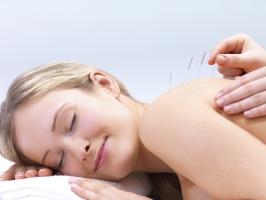 Lợi ích của phương pháp châm cứu trong chữa bệnh