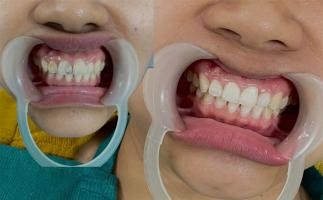 Phòng khám nha khoa uy tín nhất TP. Quy Nhơn, Bình Định