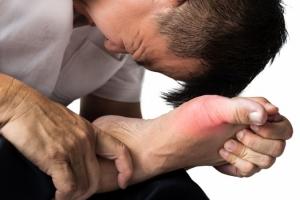 Thực phẩm đẩy lùi bệnh gout hiệu quả nhất
