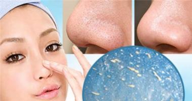 Sữa rửa mặt trị mụn đầu đen cực hiệu quả