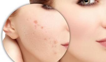 Địa chỉ trị thâm uy tín nhất tỉnh Phú Yên