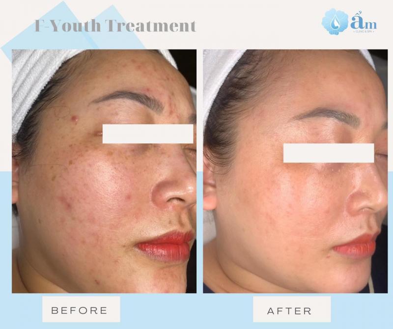 Ẩm spa & clinic