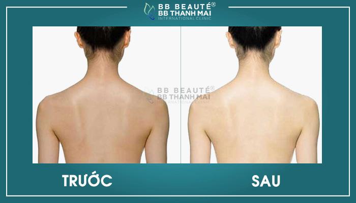 BB Beauté - BB Thanh Mai