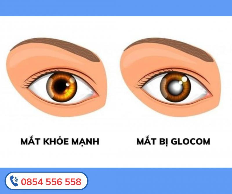Bệnh Viện Mắt Việt Nhật