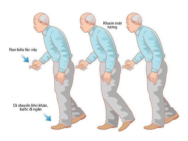 Bệnh viện Nhân dân 115