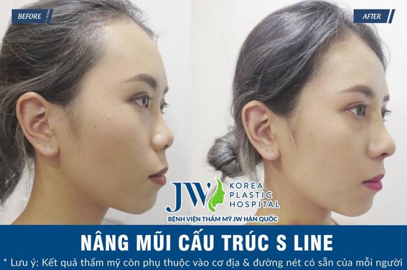 Bệnh viện phẫu thuật thẩm mỹ JW Hàn Quốc