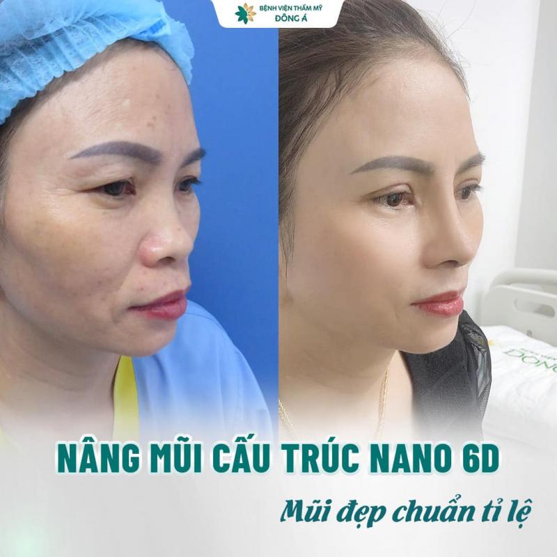Bệnh viện thẩm mỹ Đông Á