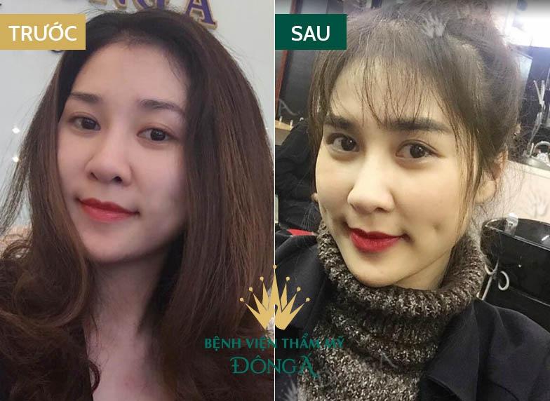 Bệnh viện thẩm mỹ Đông Á