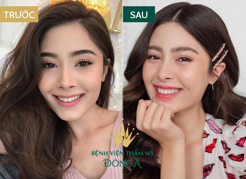 Bệnh viện thẩm mỹ Đông Á