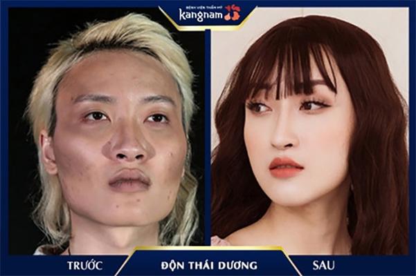 Bệnh viện thẩm mỹ Kangnam