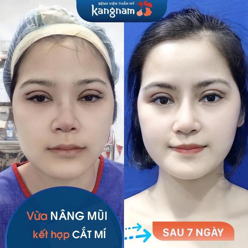 Thẩm mỹ viện KangNam