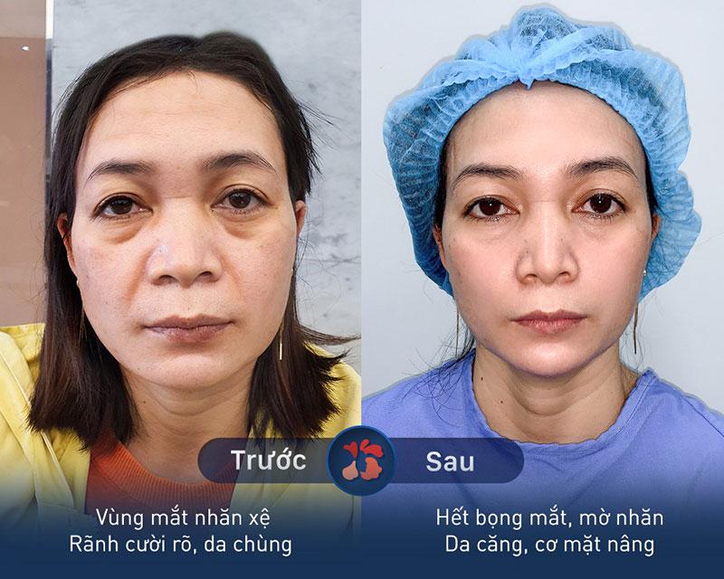 Bệnh Viện Thẩm mỹ Kangnam
