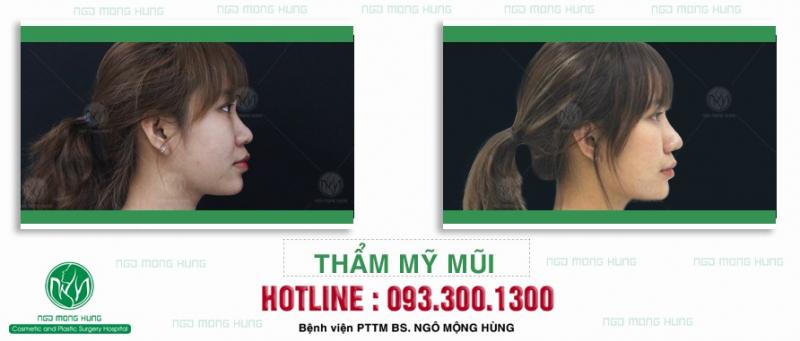 Bệnh viện thẩm mỹ Ngô Mộng Hùng