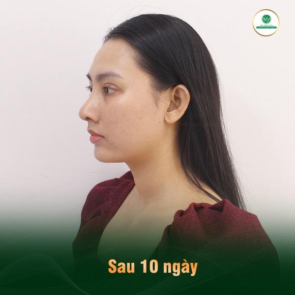 Bệnh viện thẩm mỹ Ngô Mộng Hùng