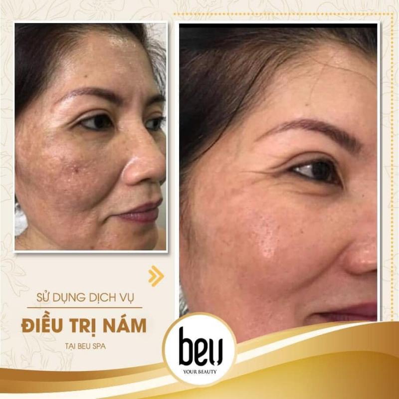 BeU Spa
