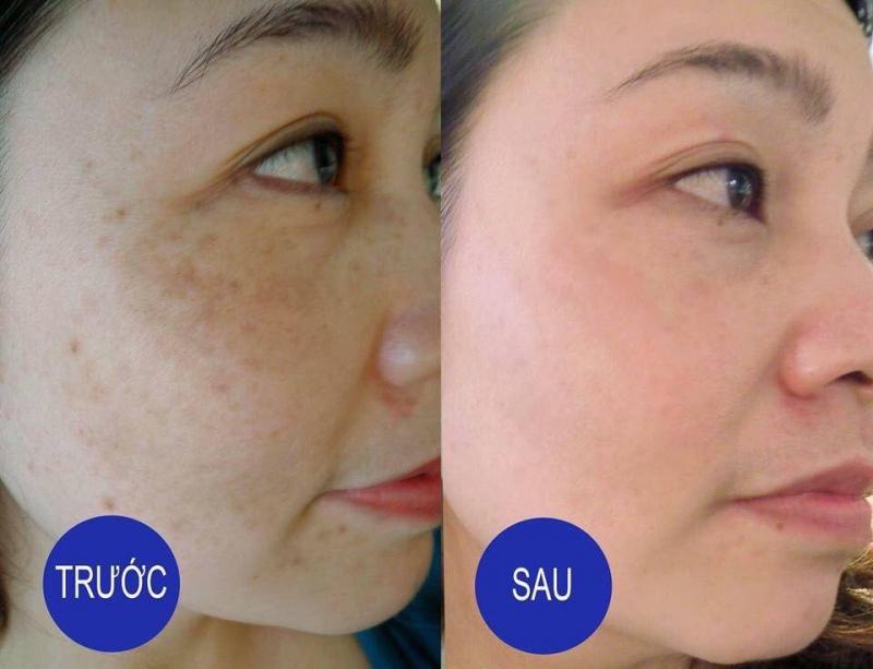 Bông Spa - Healthy & Beauty