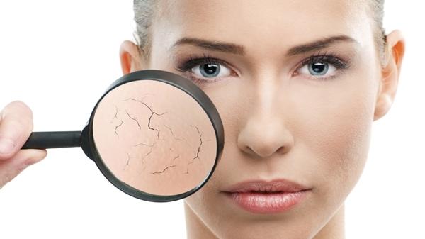 Bạn bị khô da nứt nẻ