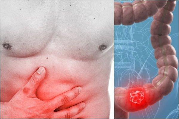 Dựa vào triệu chứng lâm sàng và các kết quả xét nghiệm, bác sĩ sẽ đưa ra chẩn đoán về giai đoạn phát triển của bệnh.