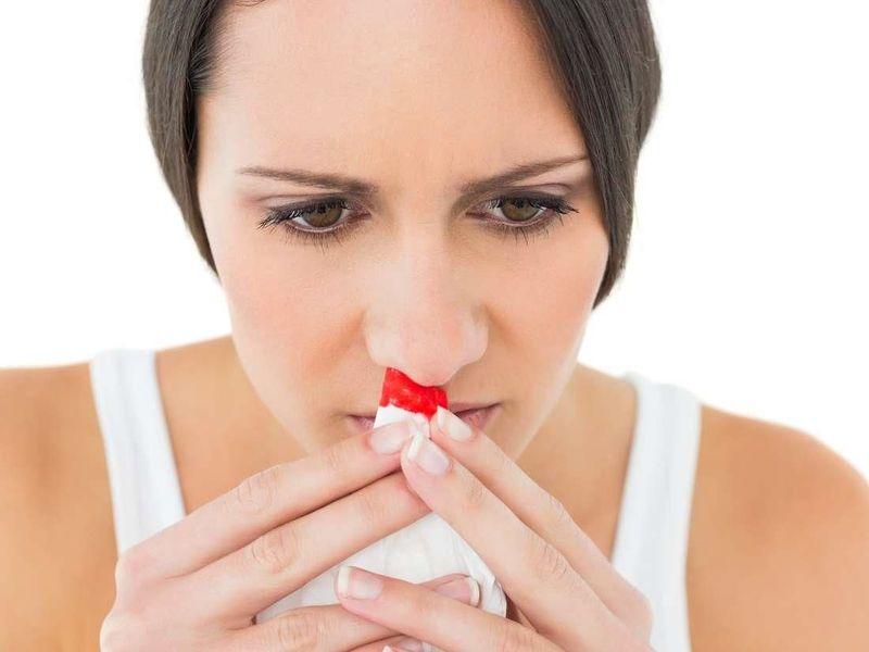 Chảy máu cam có thể dẫn đến một số bệnh nguy hiểm