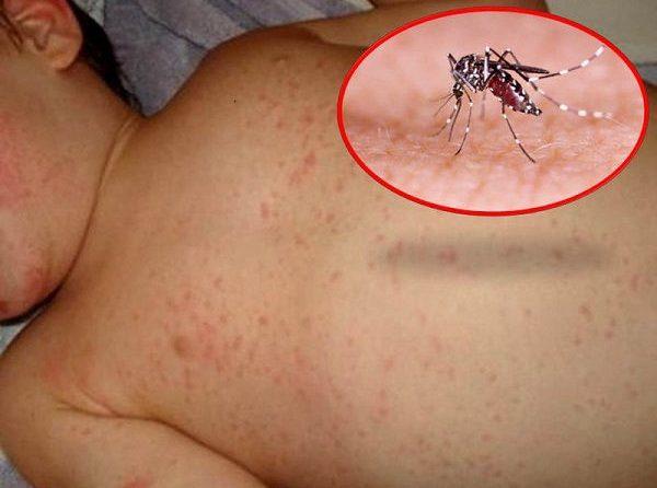 Rau diếp cá là vị thuốc thích hợp cho bệnh sốt xuất huyết.