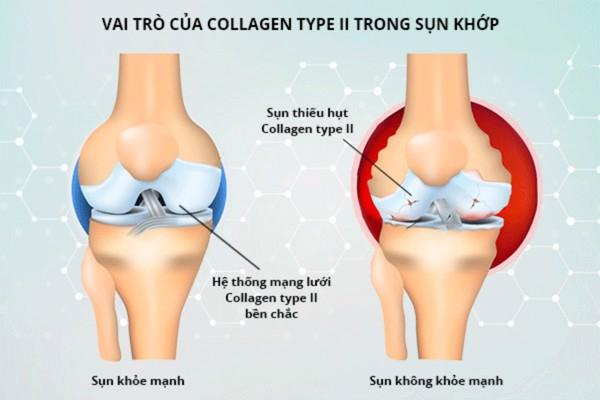 Collagen giúp xương chắc khỏe