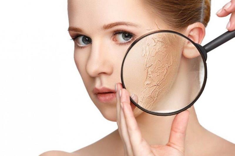 Da bạn trở nên sần sùi và chuyển sang màu vàng