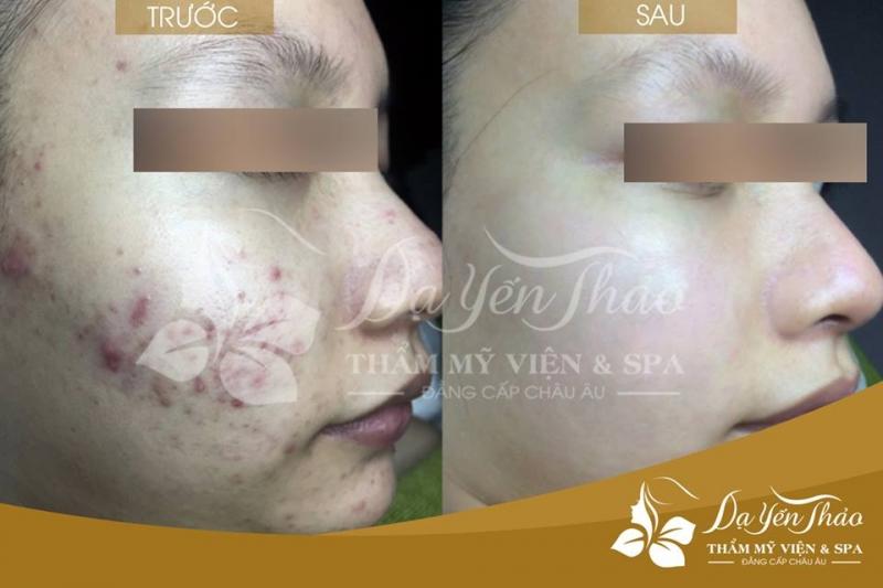 Dạ Yến Thảo spa