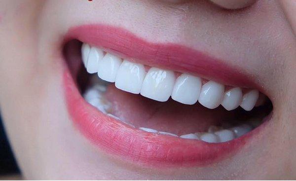 Nha khoa Thẩm mỹ Việt Đức
