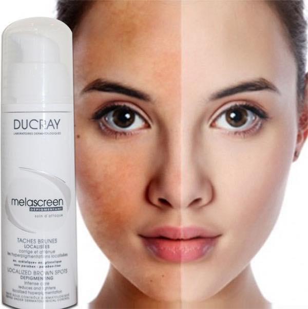 Kem trị nám Ducray