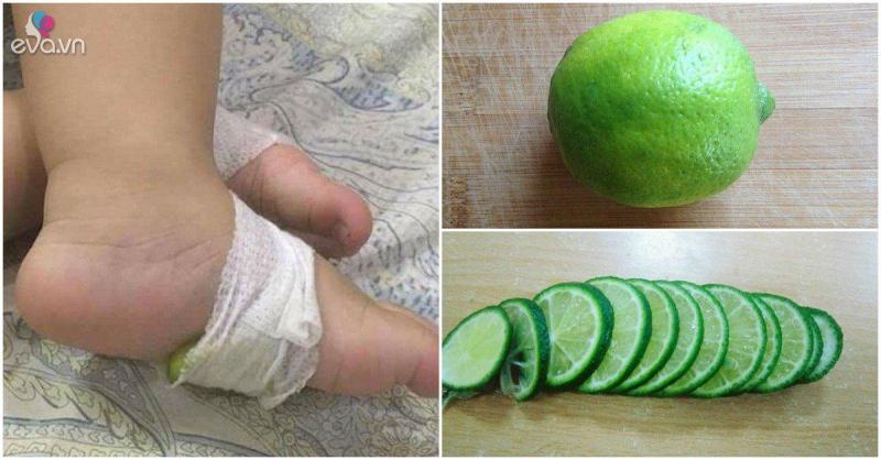 Dùng chanh tươi để hạ sốt, kể cả sốt cao