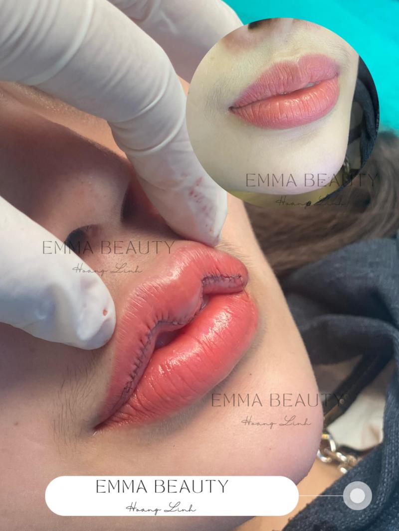 Emma Beauty