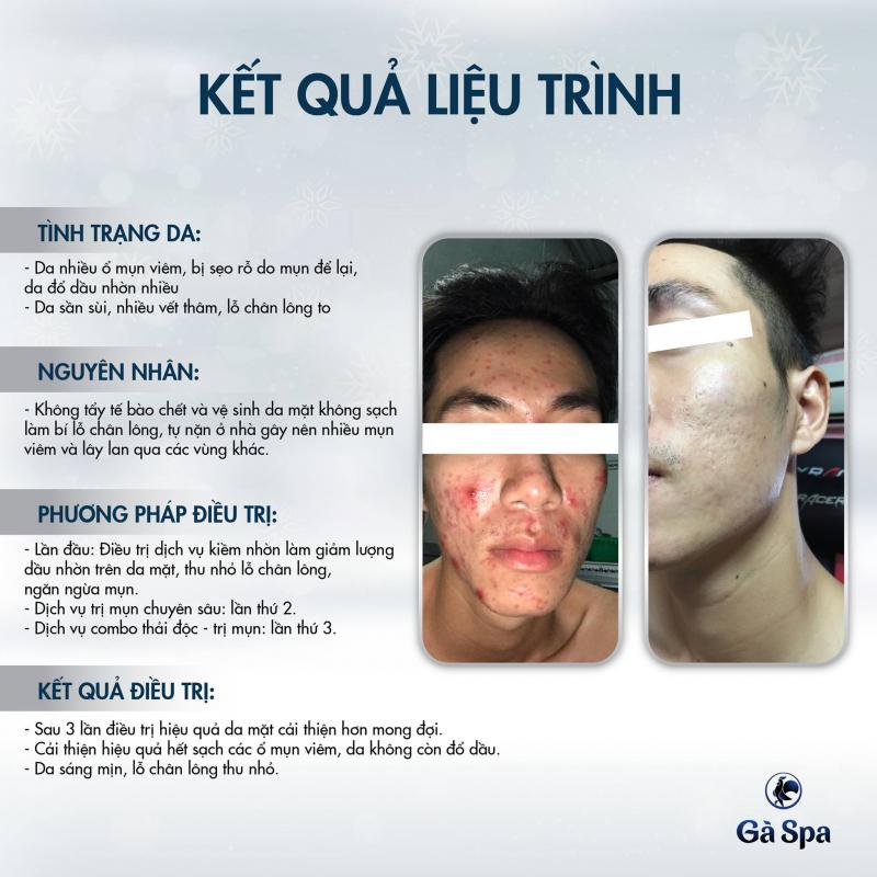 Gà Spa Cần Thơ