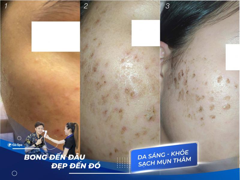 Gà Spa Cần Thơ