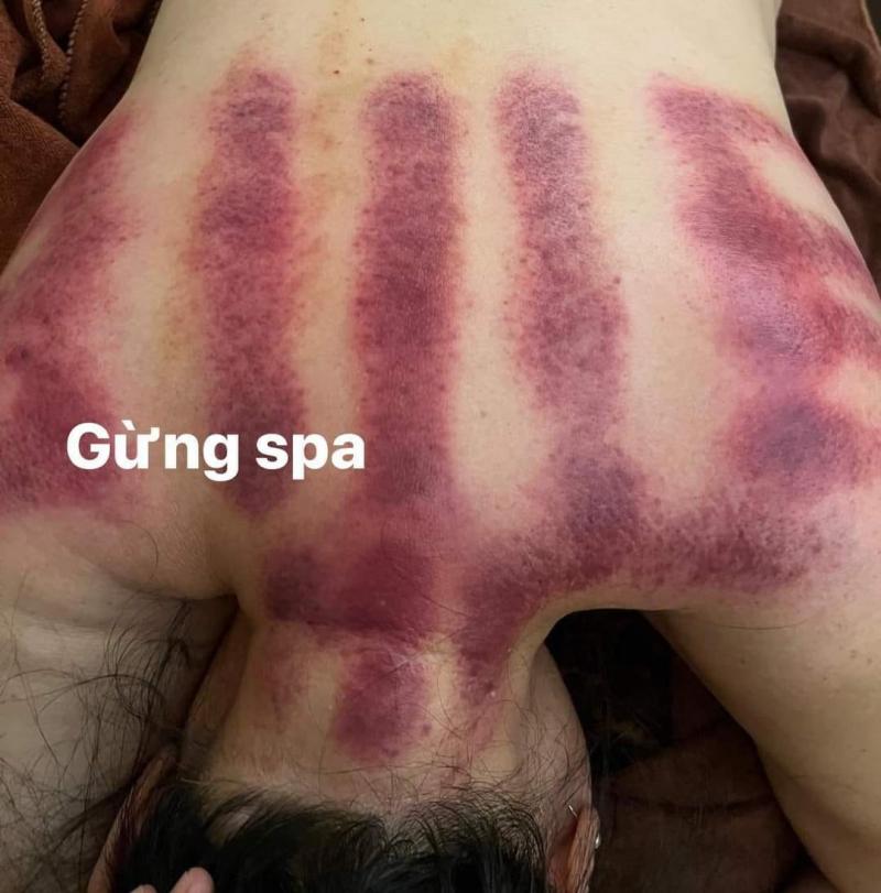 Gừng Spa Khuông Việt
