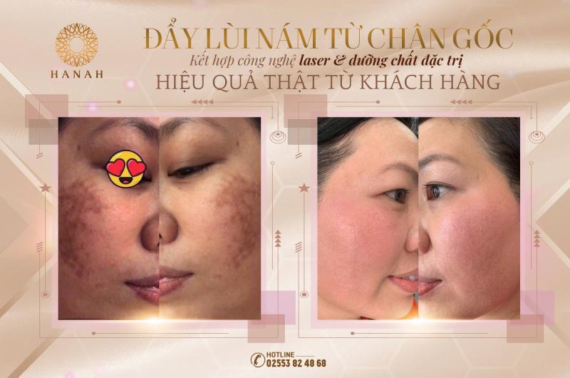 Hanah Clinic & Spa