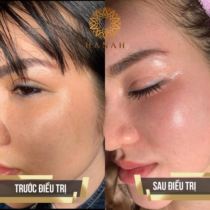 Hanah Clinic & Spa