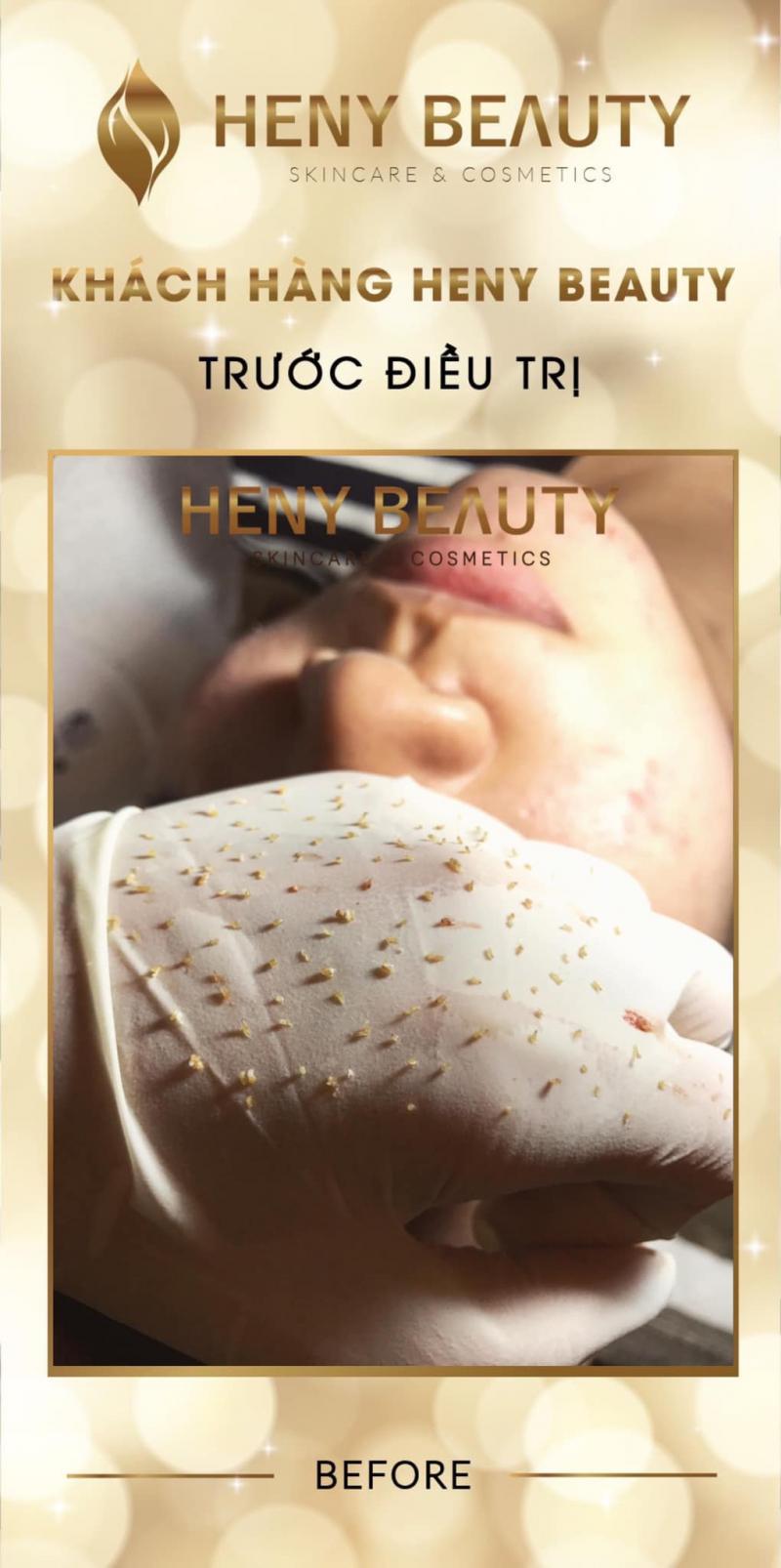 Henry Beauty