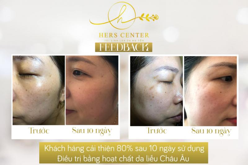 Hers Center
